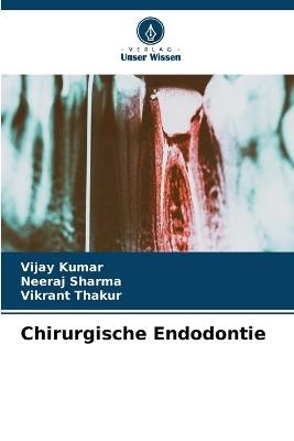 Chirurgische Endodontie - Vijay Kumar,Neeraj Sharma,Vikrant Thakur - cover