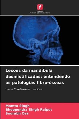 Les?es da mand?bula desmistificadas: entendendo as patologias fibro-?sseas - Mamta Singh,Bhoopendra Singh Rajput,Sourabh Oza - cover