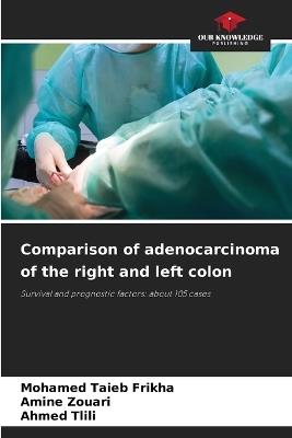 Comparison of adenocarcinoma of the right and left colon - Mohamed Taieb Frikha,Amine Zouari,Ahmed Tlili - cover