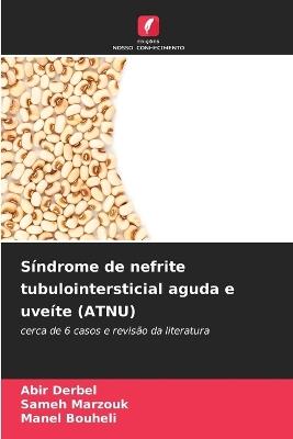 S?ndrome de nefrite tubulointersticial aguda e uve?te (ATNU) - Abir Derbel,Sameh Marzouk,Manel Bouheli - cover