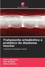 Tratamento ortod?ntico e prot?tico do diastema maxilar