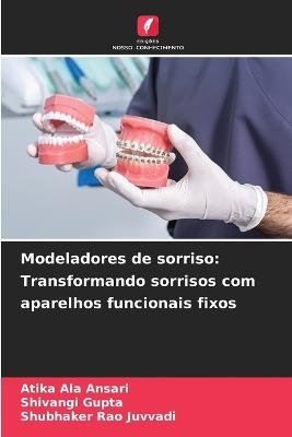 Modeladores de sorriso: Transformando sorrisos com aparelhos funcionais fixos - Atika Ala Ansari,Shivangi Gupta,Shubhaker Rao Juvvadi - cover