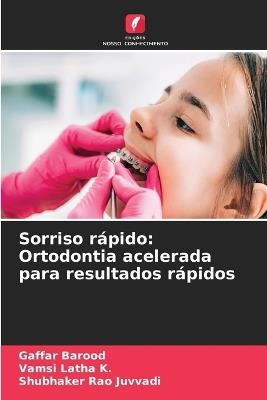 Sorriso r?pido: Ortodontia acelerada para resultados r?pidos - Gaffar Barood,Vamsi Latha K,Shubhaker Rao Juvvadi - cover