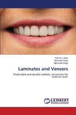 Laminates and Veneers