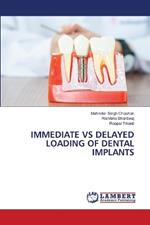 Immediate Vs Delayed Loading of Dental Implants