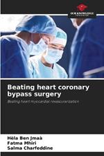 Beating heart coronary bypass surgery