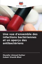 Une vue d'ensemble des infections bactériennes et un aperçu des antibactériens