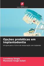 Opções protéticas em Implantodontia