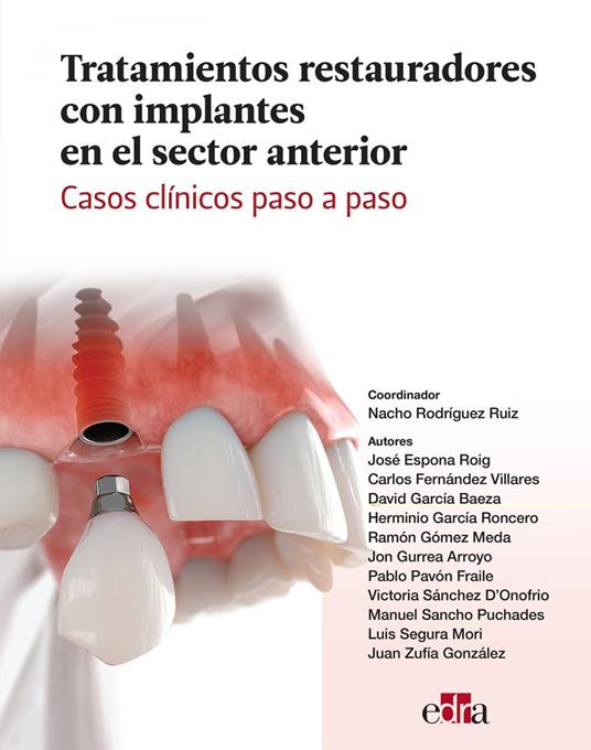 Tratamientos restauradores con implantes en el sector anterior. Casos clínicos paso a paso