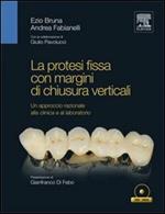 La protesi fissa con margini di chiusura verticali