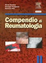 Compendio di reumatologia