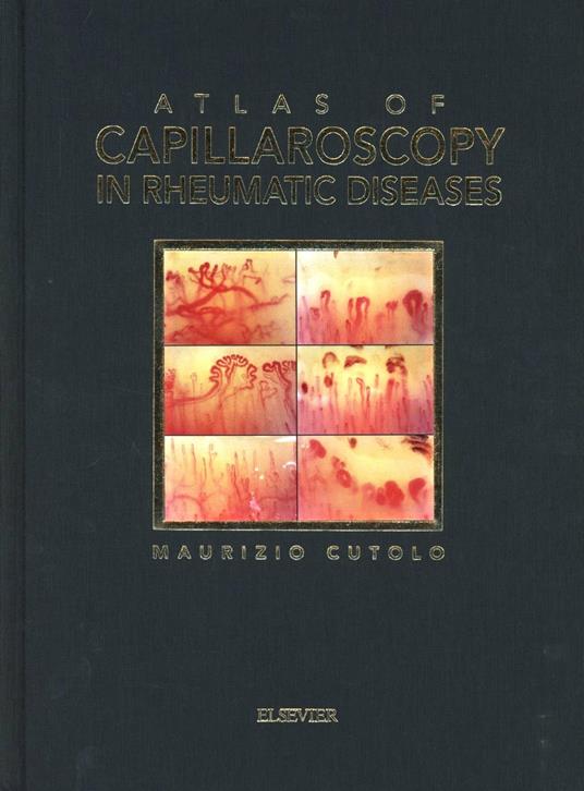 Atlas of capillaroscopy in rheumatic diseases - Maurizio Cutolo - copertina