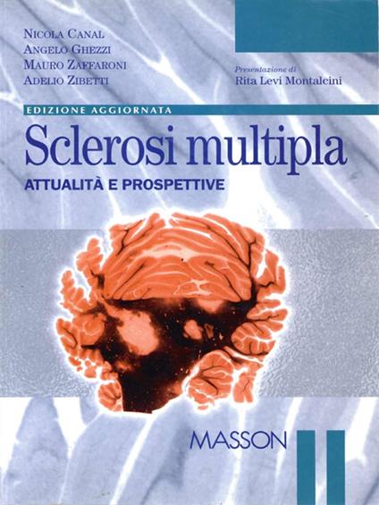 Sclerosi multipla. Attualità e prospettive - Nicola Canal,Angelo Ghezzi,Mauro Zaffaroni - ebook