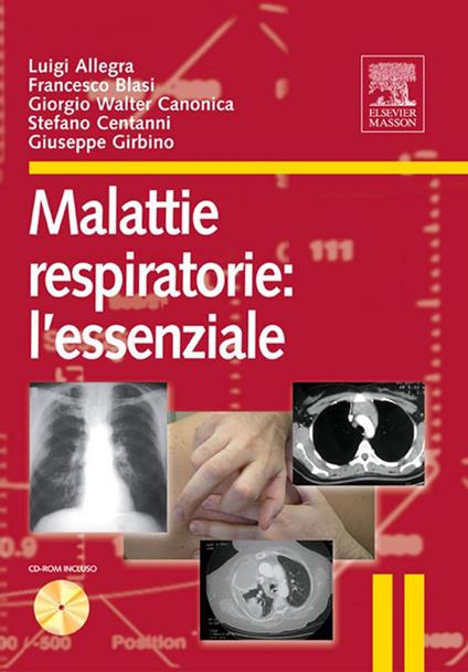 Malattie respiratorie: l'essenziale - Luigi Allegra,Francesco Blasi,Giorgio Walter Canonica,Stefano Centanni - ebook