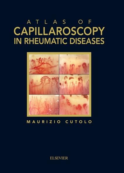 Atlas of capillaroscopy in rheumatic diseases