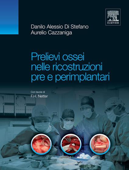 Prelievi ossei nelle ricostruzioni pre e perimplantari - Aurelio Cazzaniga,Danilo Alessio Di Stefano - ebook