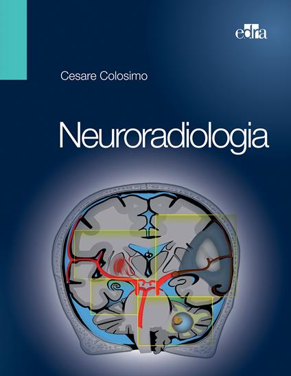 Neuroradiologia - Cesare Colosimo - ebook