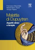 La malattia di Dupuytren