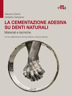 La cementazione adesiva su denti naturali. Materiali e tecniche