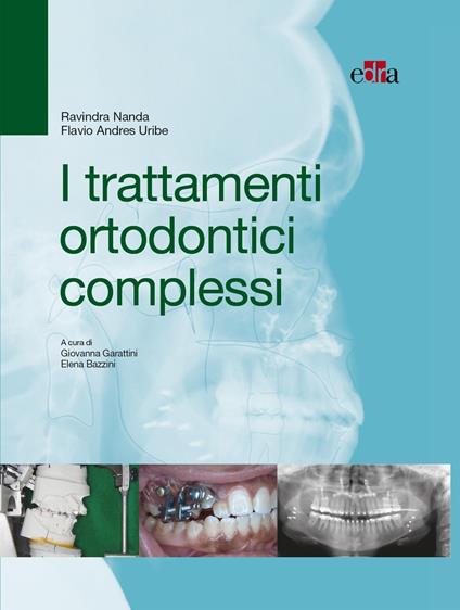 I trattamenti ortodontici complessi - Ravindra Nanda,Flavio Andreas Uribe,Elena Bazzini,Giovanna Garattini - ebook