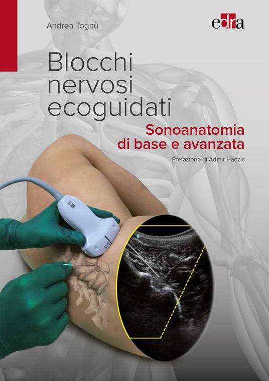 Blocchi nervosi ecoguidati. Sonoanatomia di base avanzata - Andrea Tognù - ebook