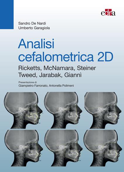 Analisi cefalometrica 2D - Sandro De Nardi,Umberto Garagiola - ebook