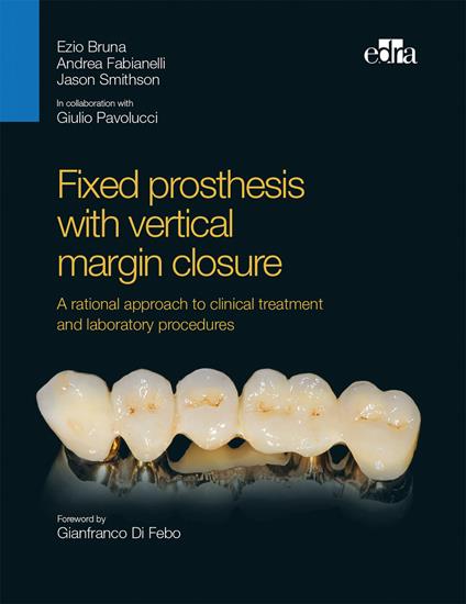 Fixed prosthesis with vertical margin closure. A rational approach to clinical treatment and laboratory procedures - Ezio Bruna,Andrea Fabianelli,Jason Smithson - copertina