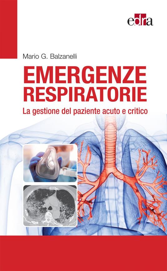 Emergenze respiratorie. La gestione del paziente acuto e critico - Mario Giosuè Balzanelli - ebook