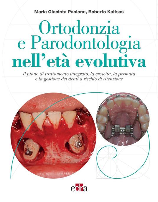 Ortodonzia e parodontologia nell'età evolutiva. Il piano di trattamento integrato, la crescita, la permuta e la gestione dei denti a rischio di ritenzione - Roberto Kaitsas,Maria Giacinta Paolone - ebook