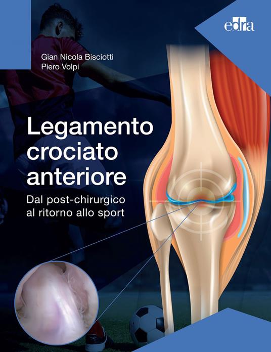 Legamento crociato anteriore. Dal post-chirurgico al ritorno allo sport - Gian Nicola Bisciotti,Piero Volpi - ebook