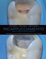 Incappucciamento diretto della polpa dentale. Procedure e tecniche operative per preservare la vitalità pulpare