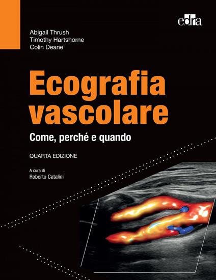 Ecografia vascolare. Come, perché e quando - Colin Deane,Timothy Hartshorne,Abigail Thrush,Roberto Catalini - ebook