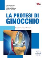 La protesi di ginocchio