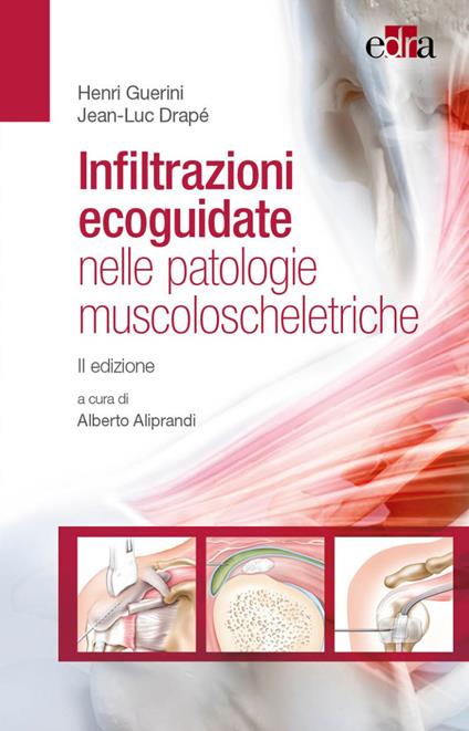 Infiltrazioni ecoguidate nelle patologie muscoloscheletriche - Henri Guerin,Jean-Luc Drapè - copertina