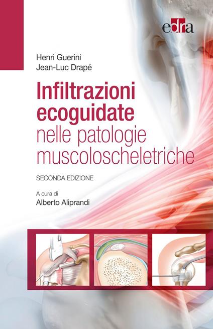 Infiltrazioni ecoguidate nelle patologie muscoloscheletriche - Jean-Luc Drapè,Henri Guerin,Alberto Aliprandi - ebook