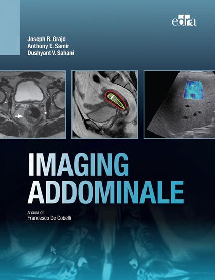 Imaging addominale - Joseph R. Grajo,Dushyant Sahani,Anthony E. Samir,Francesco De Cobelli - ebook