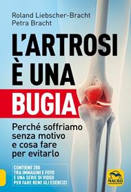 L'artrosi è una bugia. Perché soffriamo senza motivo e cosa fare per evitarlo