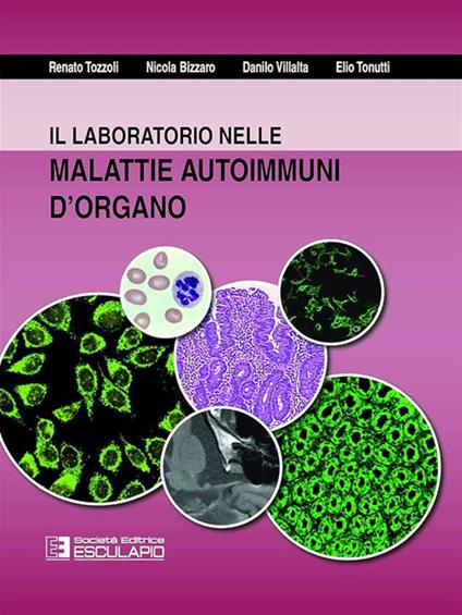 Il laboratorio nelle malattie autoimmuni d'organo - Nicola Bizzaro,Elio Tonutti,Renato Tozzoli,Danilo Villalta - ebook