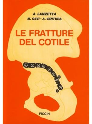 Le fratture del cotile - Albino Lanzetta,Maurizio Gevi,Alberto Ventura - copertina