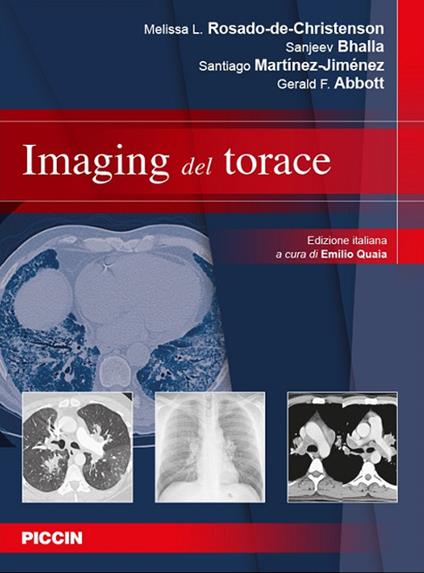 Imaging del torace - Melissa L. Rosado-de-Christenson,Sanjeev Bhalla,Santiago Martínez-Jiménez - copertina