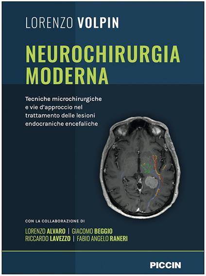 Neurochirurgia moderna. Tecniche microchirurgiche e vie d'approccio nel trattamento delle lesioni endocraniche encefaliche - Lorenzo Volpin - copertina