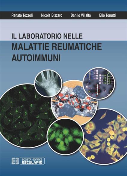 Il laboratorio nelle malattie reumatiche autoimmuni - Nicola Bizzaro,Elio Tonutti,Renato Tozzoli,Danilo Villalta - ebook