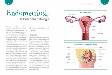 La dieta anti endometriosi. L'alimentazione antinfiammatoria per ridurre i sintomi e vivere meglio - Pietro Giulio Signorile,Maria Cassano - 5