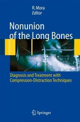 Nununion of the long bones. Diagnosis and treatment with compression-distraction techniques - Redento Mora - copertina