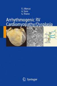 Arrhythmogenic RV cardiomyopathy/dysplasia recent advances - copertina