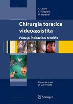 Chirurgia toracica videoassistita