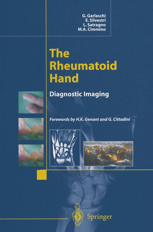 The Rheumatoid Hand