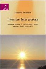 Il tumore della prostata. Manuale pratico di radioterapia esterna del carcinoma prostatico