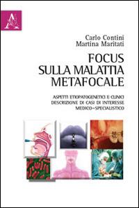 Focus sulla malattia metafocale. Aspetti etiopatogenetici e clinici. Descrizione di casi di interessi medico-specialistico - Carlo Contini,Martina Maritati - copertina