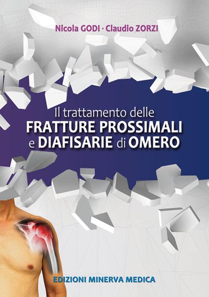 Il trattamento delle fratture prossimali diafisarie di omero - Nicola Godi,Claudio Zorzi - copertina